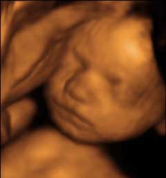 25-week 3D ultrasound